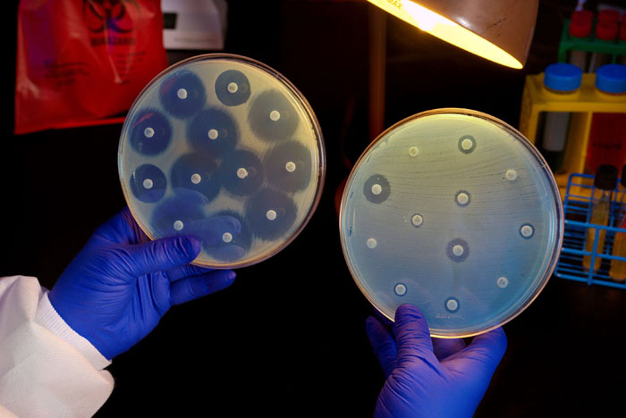 Antibiotic-resistant Bacteria 