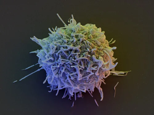 Human Lymphocyte, SEM