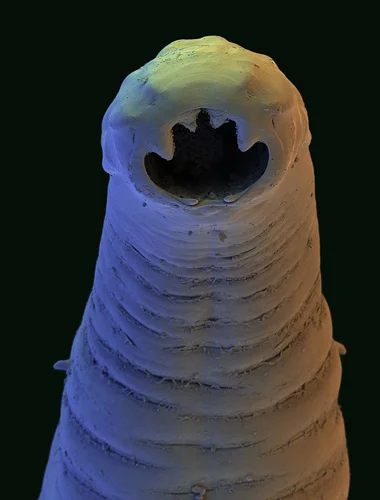 Hookworm, SEM