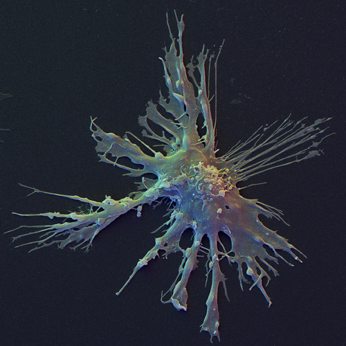 Human Dendritic Cell, SEM