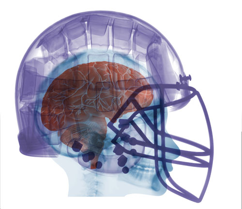 Football Helmet X-ray