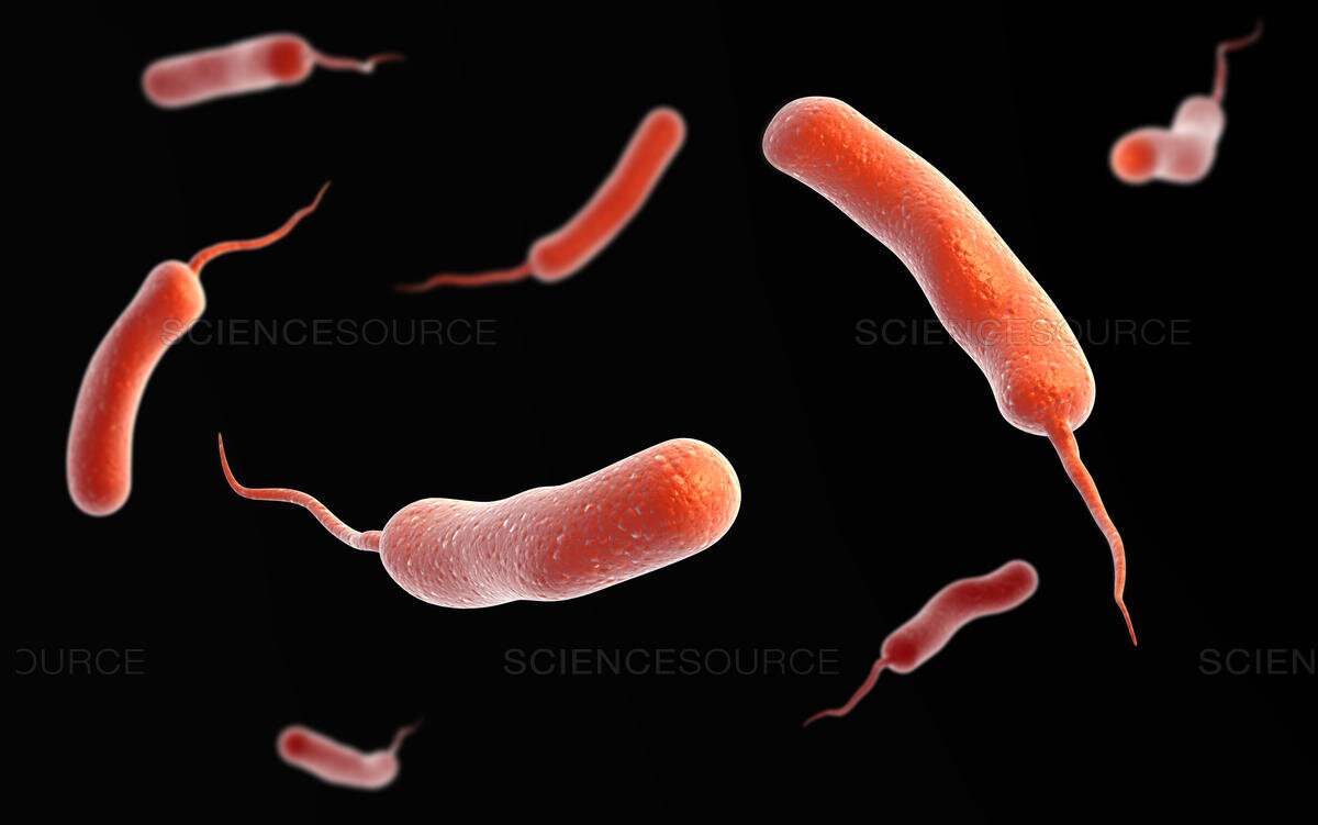 Vibrio cholerae causing cholera