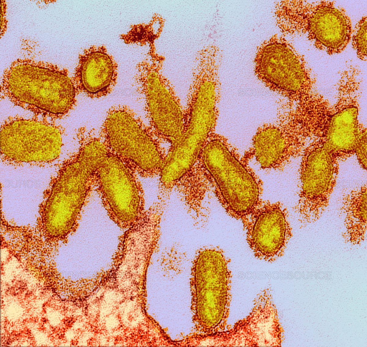 H1N1, Influenza A, 1918 Virions, TEM
