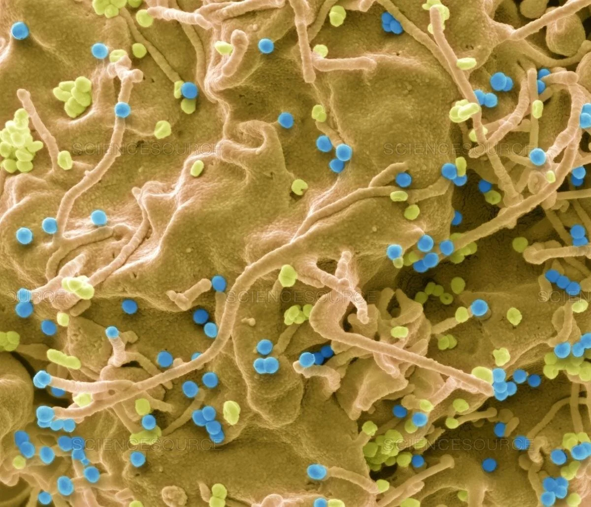 HIV infected cell, SEM