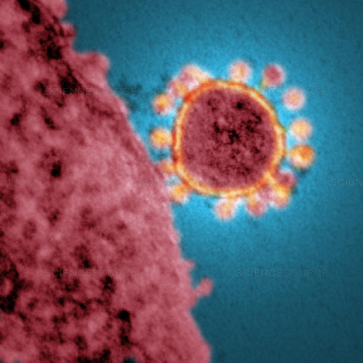 MERS Coronavirus, TEM