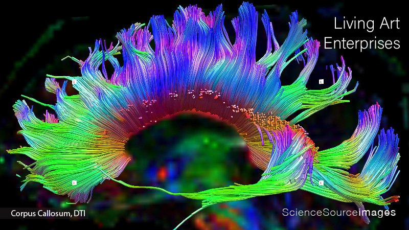 Corpus Callosum, DTI