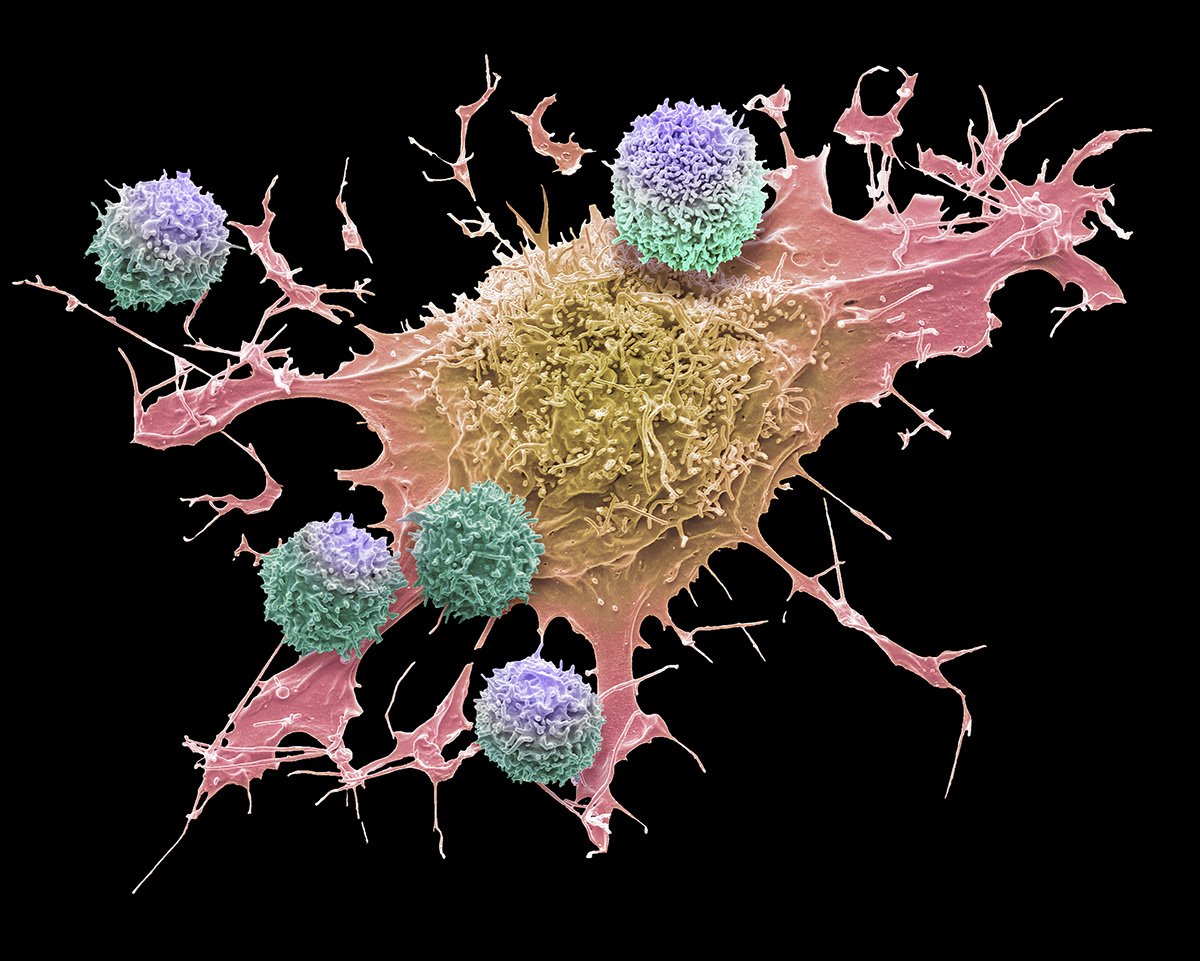  TAGS SHARE THIS PAGE CAR T-CELL THERAPY, SEM