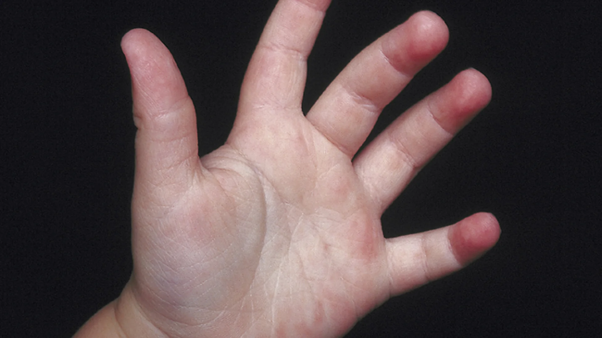 Hands Up