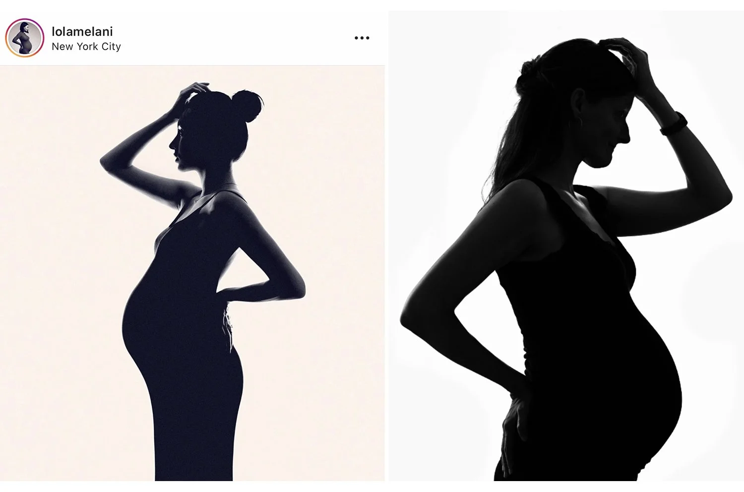 Schwangere Frau steht als Silhouette vor einem hellen Hintergrund.