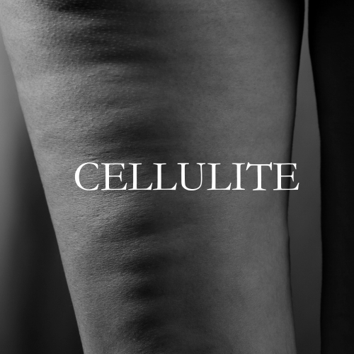 Cellulite.png