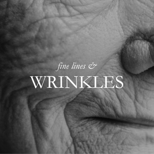 Wrinkles.png