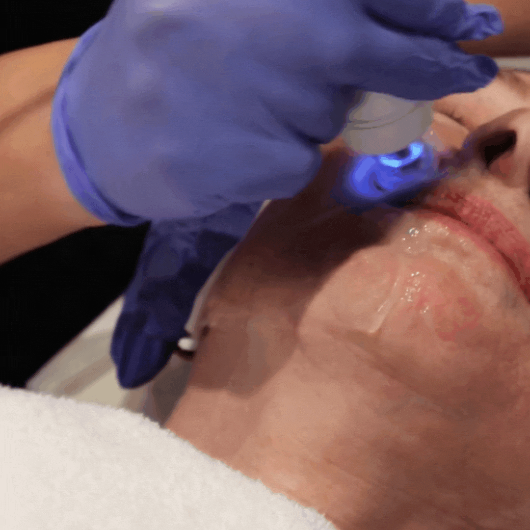TempSure Gif3.gif