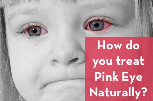 The #1 answer for treating Pink eye naturally is Good ol' fashioned Breastmilk!!!