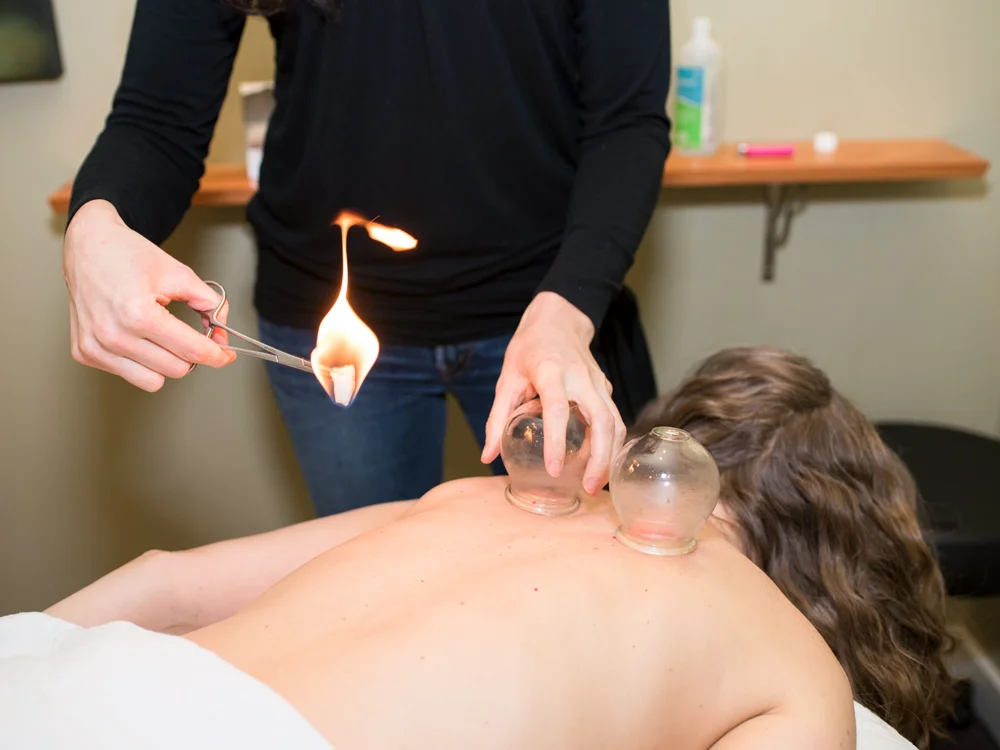 UL_Web-cupping.jpg