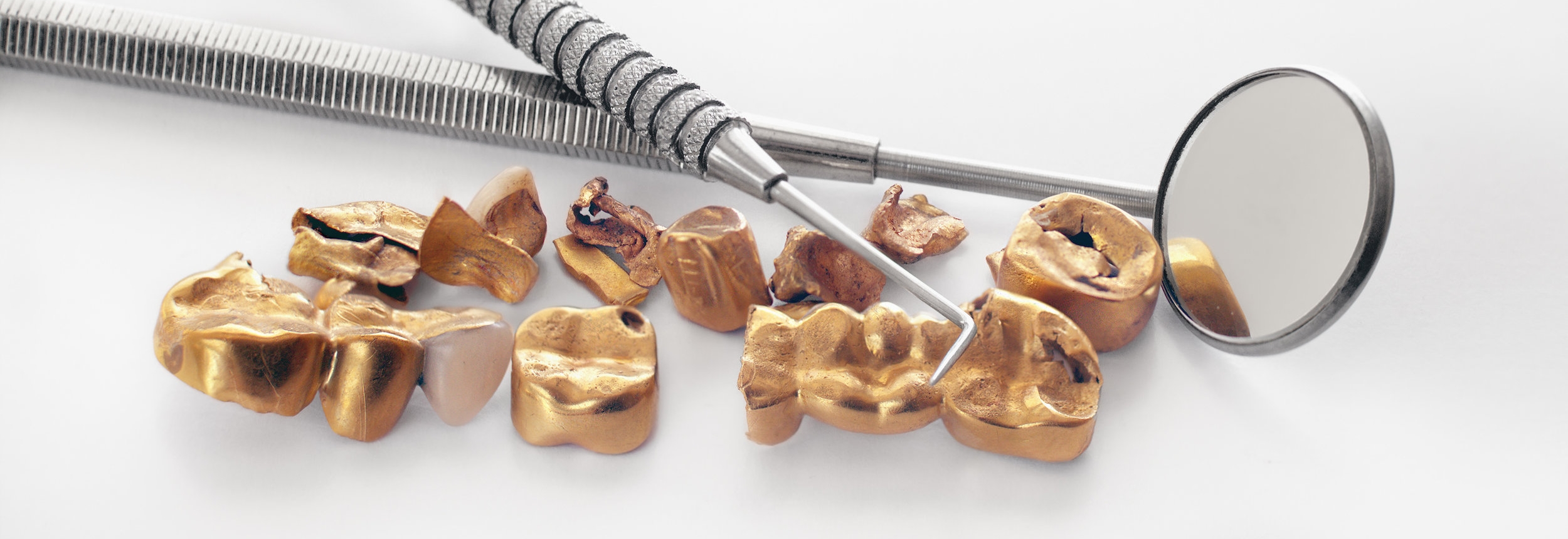 Image of an assortment of karat gold jewelry, which Specialty Metals can recycle and refine for the best prices for individuals and businesses.