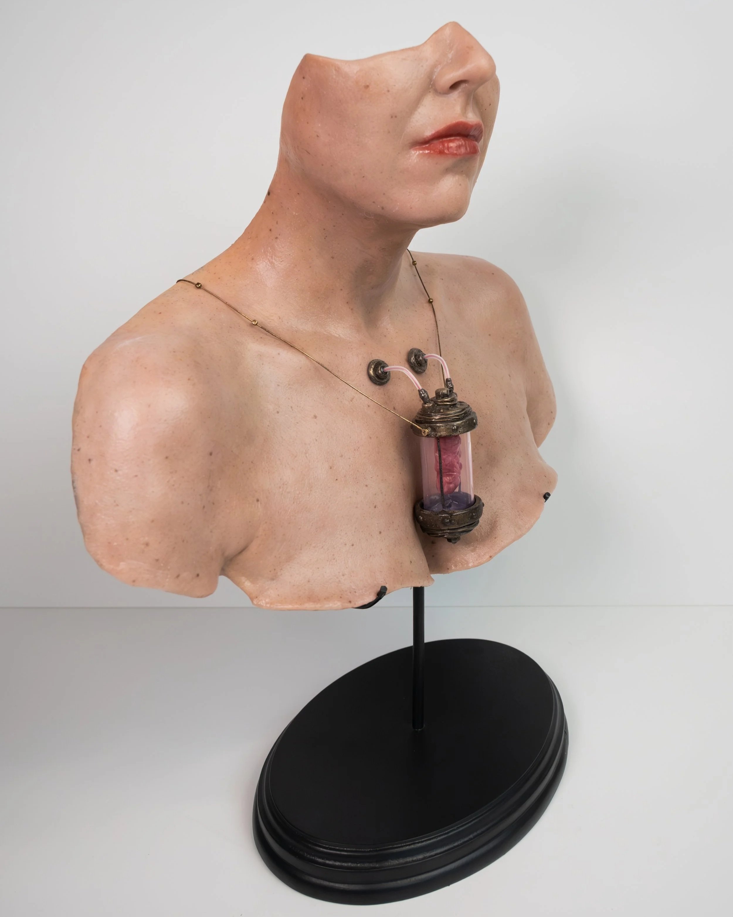 In Vitro ME (2026)