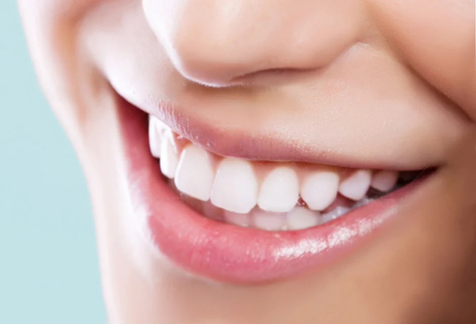 lorett smile image questions sidebar.jpg