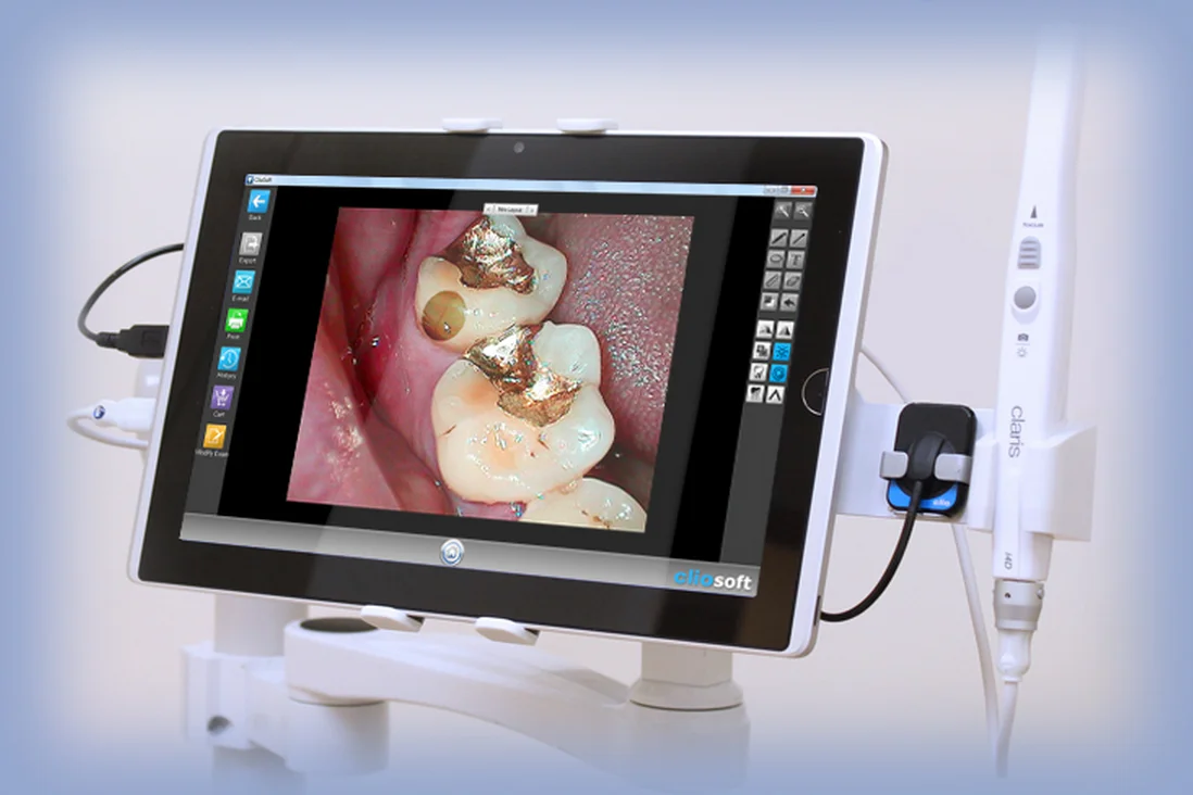 lorett SOTA screen.jpg