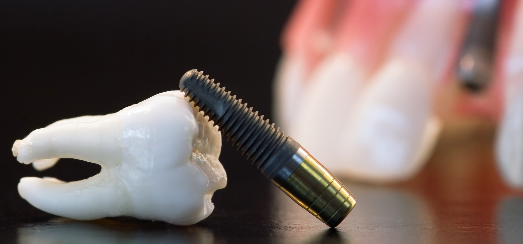 implant dentistry
