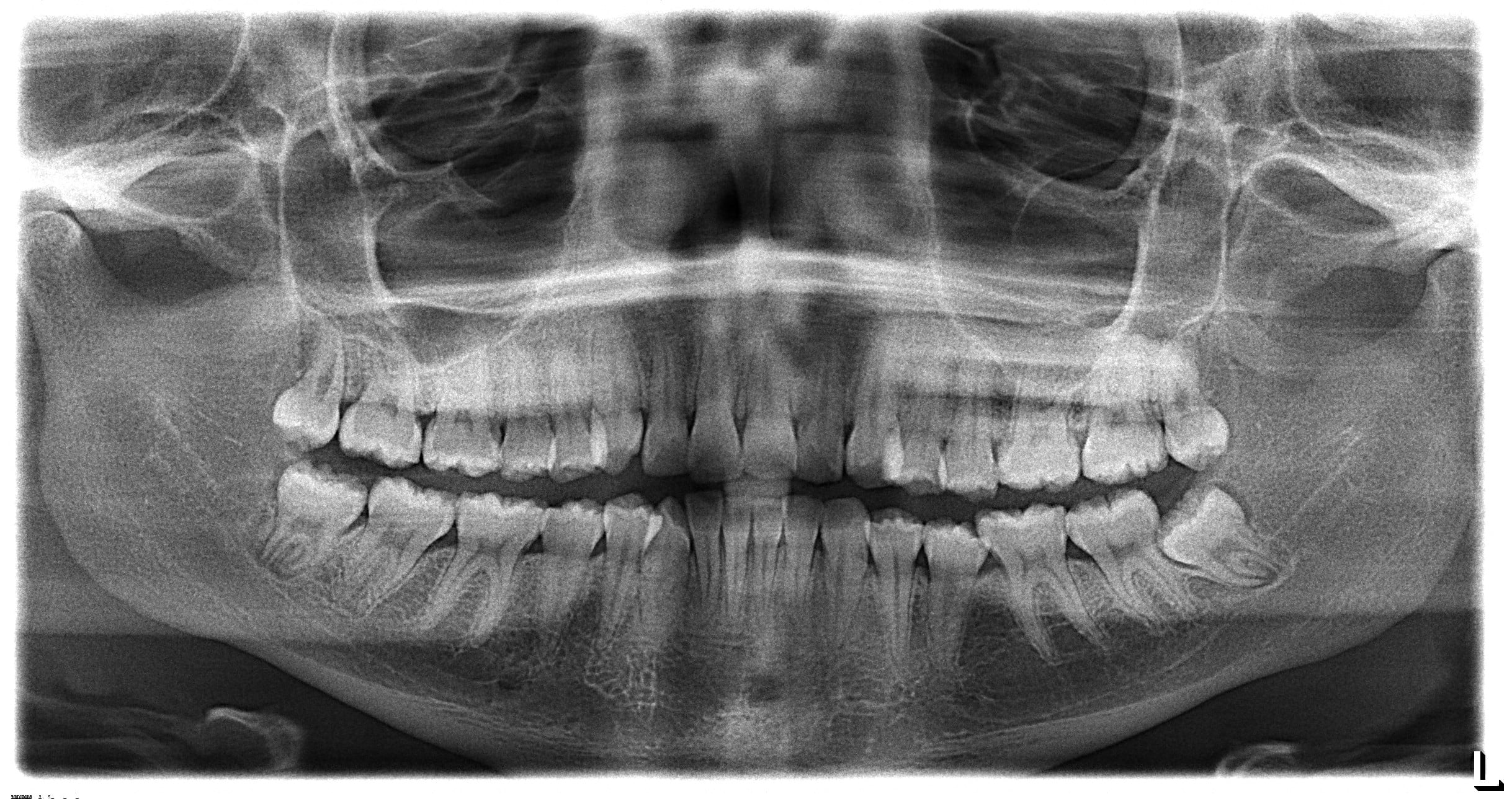 dental cleanings and exams and x-rays