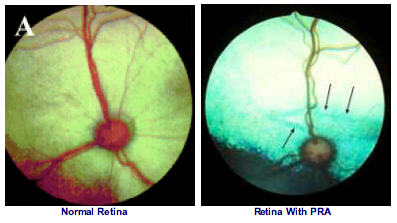 Compare the images. The image on the right has much larger and more numerous blood vessels (the red lines) than the image on the right. The reflection on the right is much brighter than on the left. 