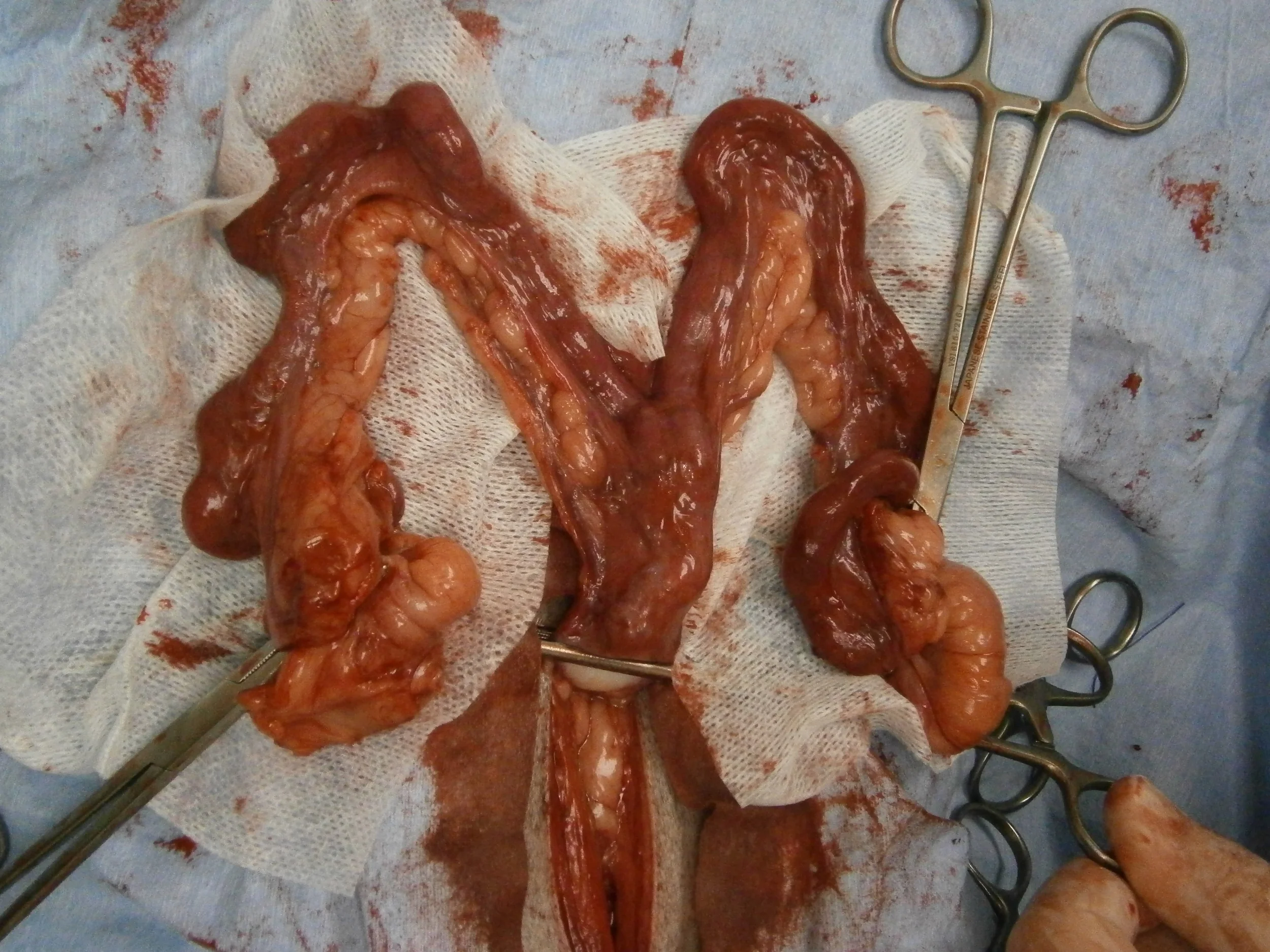 The uterus is nearly removed. My hand is holding a clamp on the cervix. The short uterine body is closest to this clamp. The clamp on each side marks the separation between the uterine horns and the ovaries at the ends. The ovaries are quite large (Compare to the size of my thumb).