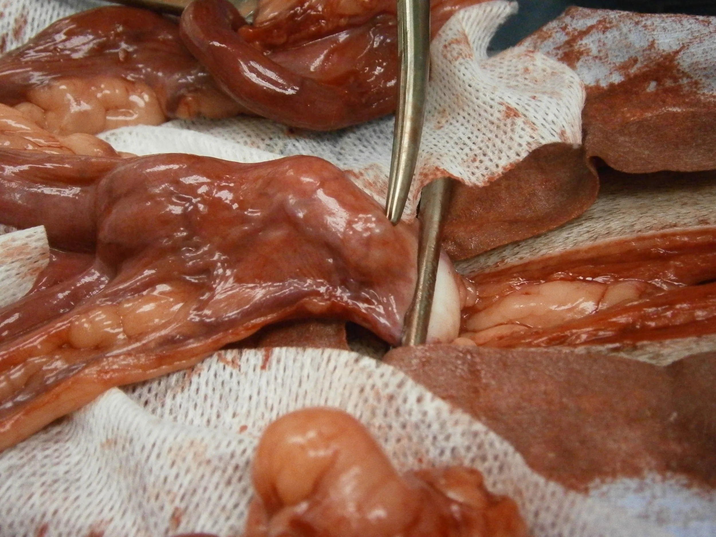 The scissors are pointing to a cystic structure in the body of the uterus.