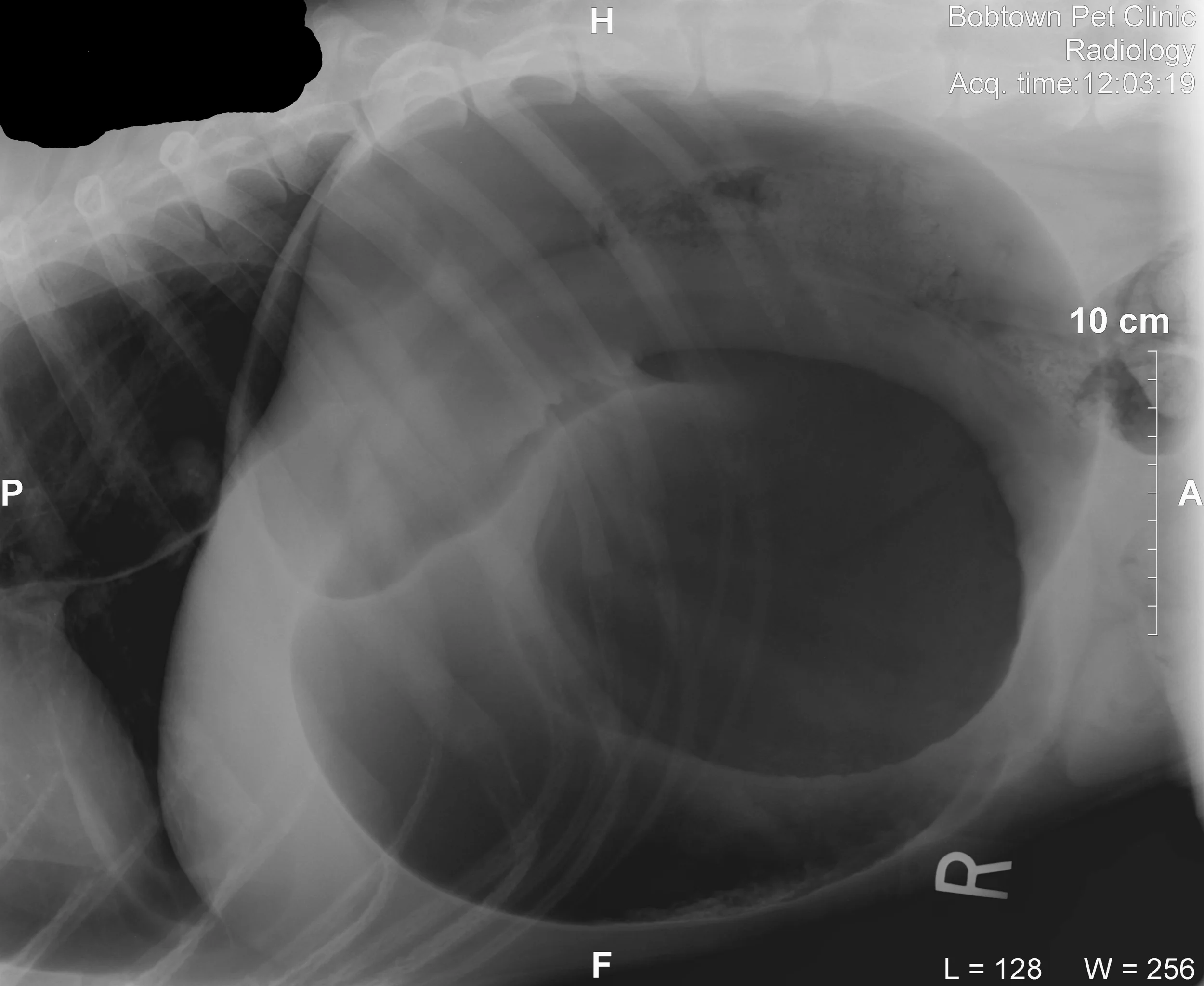 this is an x-ray of a St. Bernard with a GDV. The overlapping black round structure in the middle of the x-ray is the stomach. In this picture we can also see part of the chest with a large black tube near the spine. This is a gas dilated esophagus.