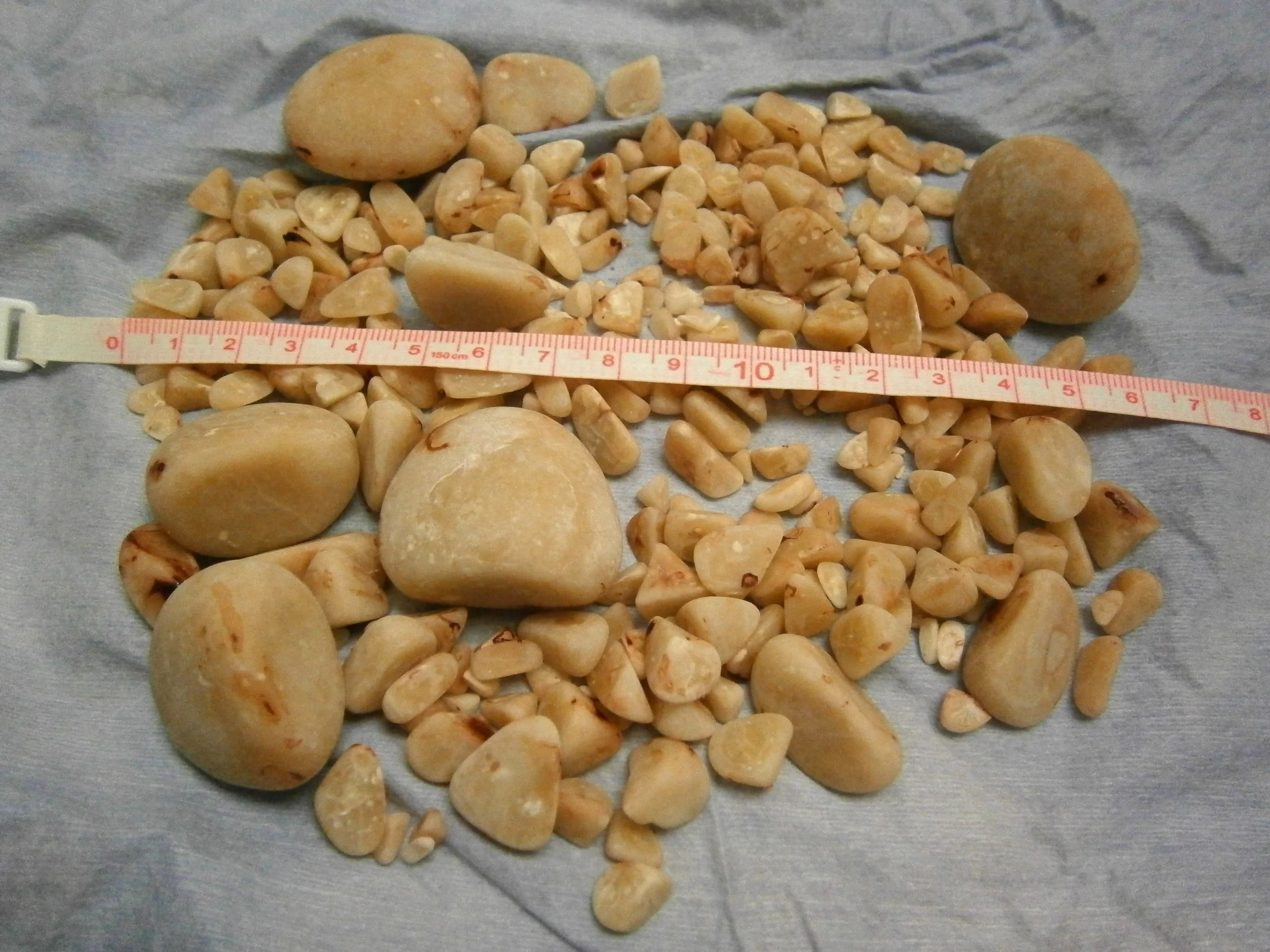 These are the stones we removed from Bobo. Note that some of these are over 4 cm long.