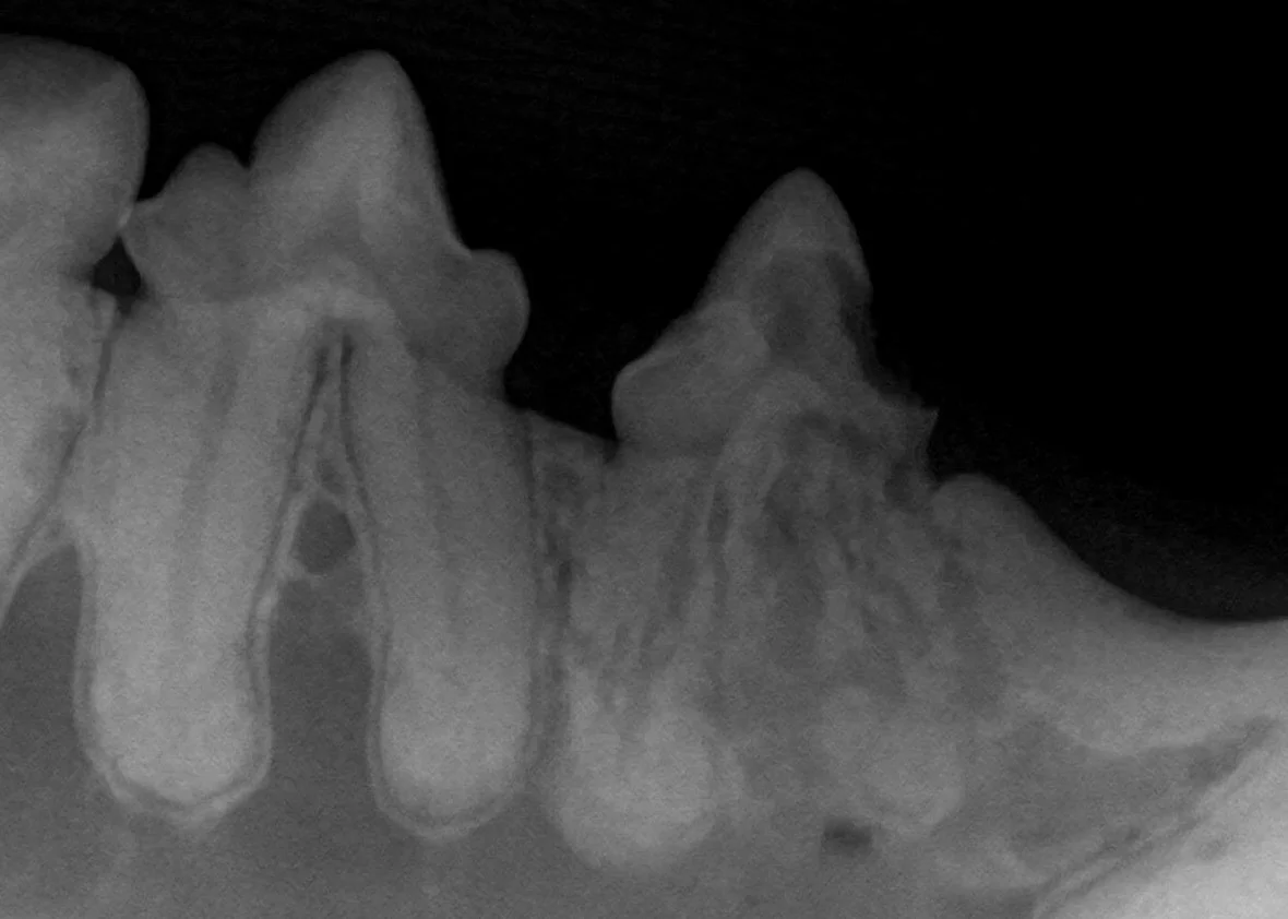 Normal tooth on left. Tooth on right has extensive resorption.
