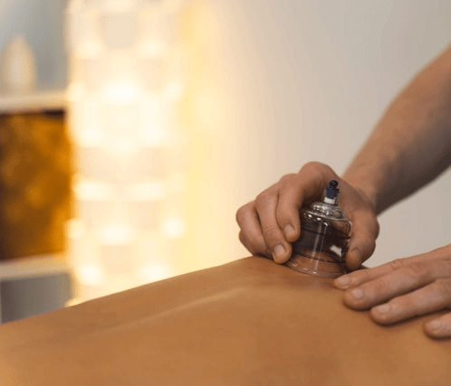 Cupping during Massage (1).png