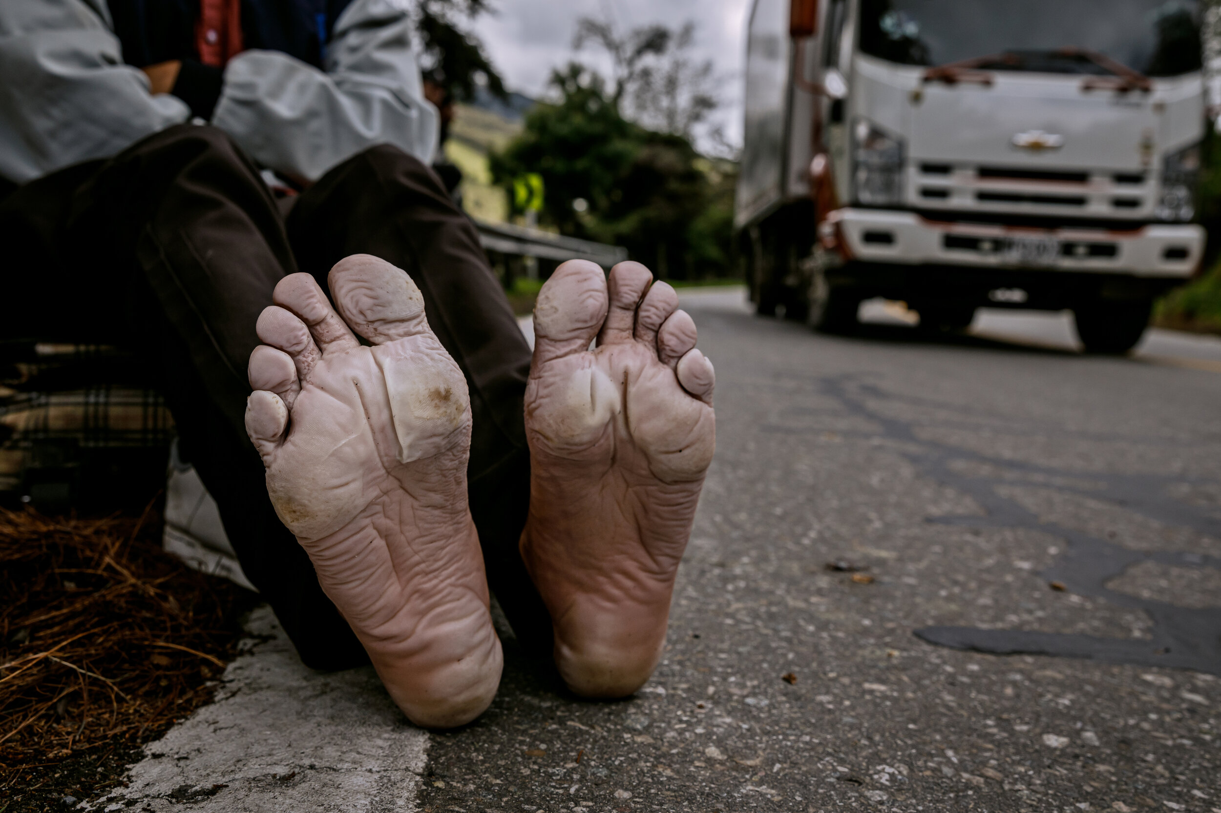  Ramon Cohil, 33, stretches his legs and airs out his feet covered entirely in a layer of dead skin, near La Laguna, Colombia. The caminantes, or walkers, have to make a perilous 120-mile journey on that climbs more than 9,000 feet to a long and frig