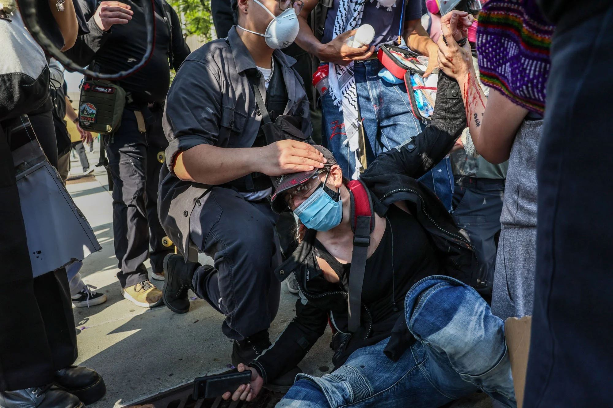  Los Angeles, CA, Sunday, June 8, 2025 - Bystanders help a woman who was bleeding after getting shot in the hand by a rubber bullet from an LAPD officer at the intersection of Temple and Los Angeles St. as protesters take to the streets to protest IC