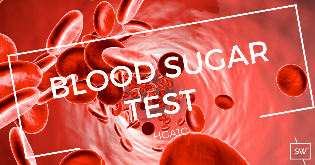 ILLUSTRATION OF BLOOD FLOWING DOWN ARTERY