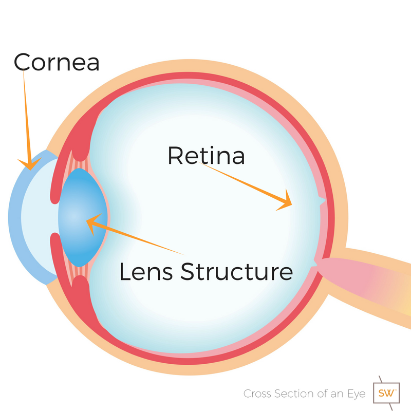 Cross section of an eye showing the location of the retina, the cornea, the lens structure and where a cataract will develop. 