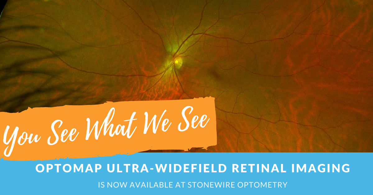 You see what we see - optomap ultra-widefield retinal imaging at Stonewire Optometry in Edmonton.png