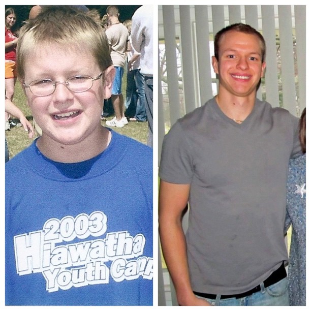 My Band Flex before and after... as well as a couple of years post adolescence.