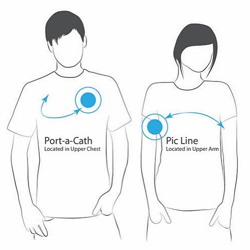 Learn how One Day Apparel's Specialty Garment aids those undergoing treatment at www.onedayapparel.com/shop/ #cancerresearch #onedayatatime #findacure #teamwork