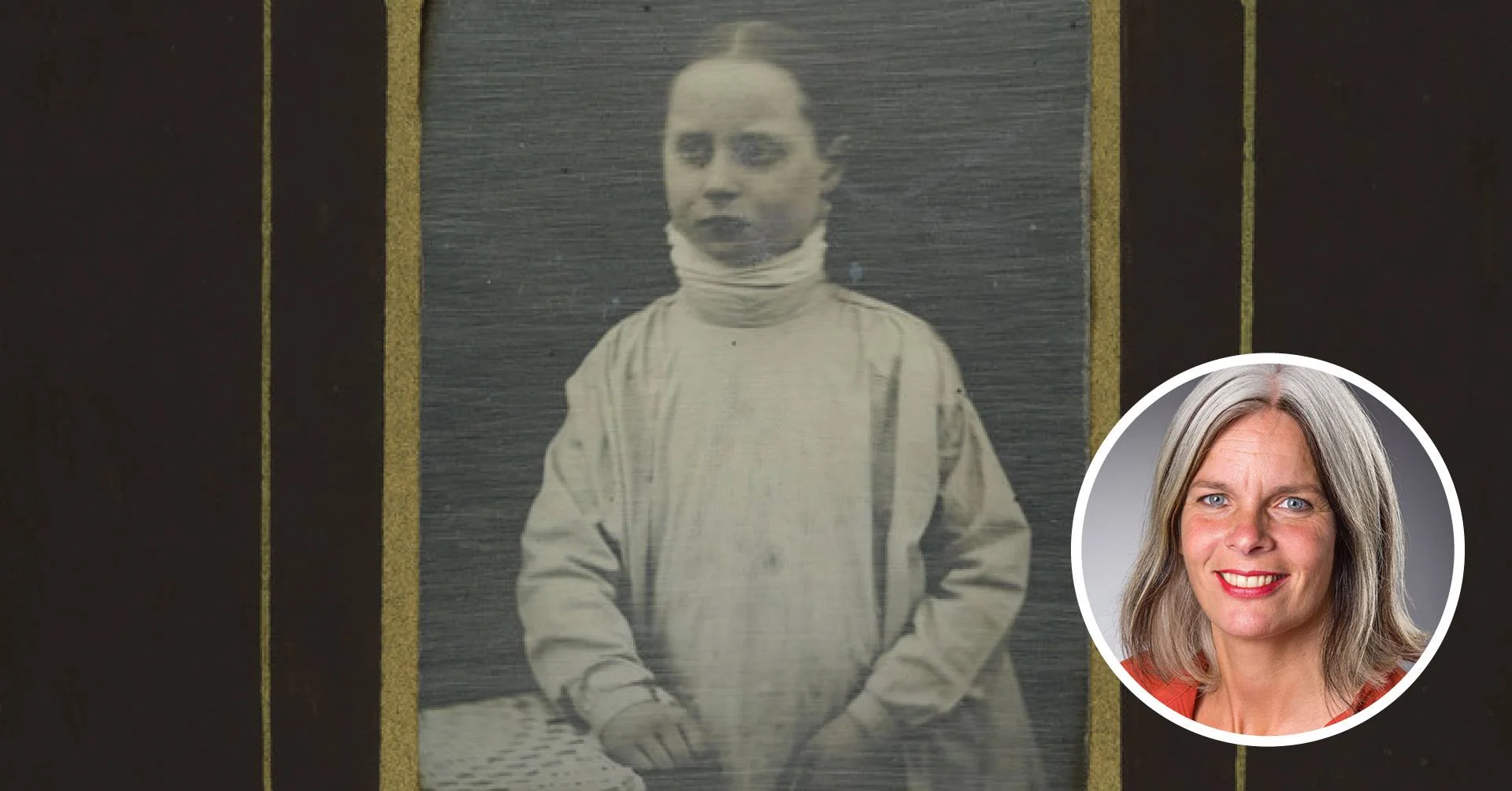 Den norske sjukdommen. Anne Kveim Lie om radesjuken