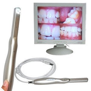 intraoral camera.jpeg