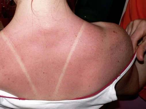 Put On That Sunscreen...