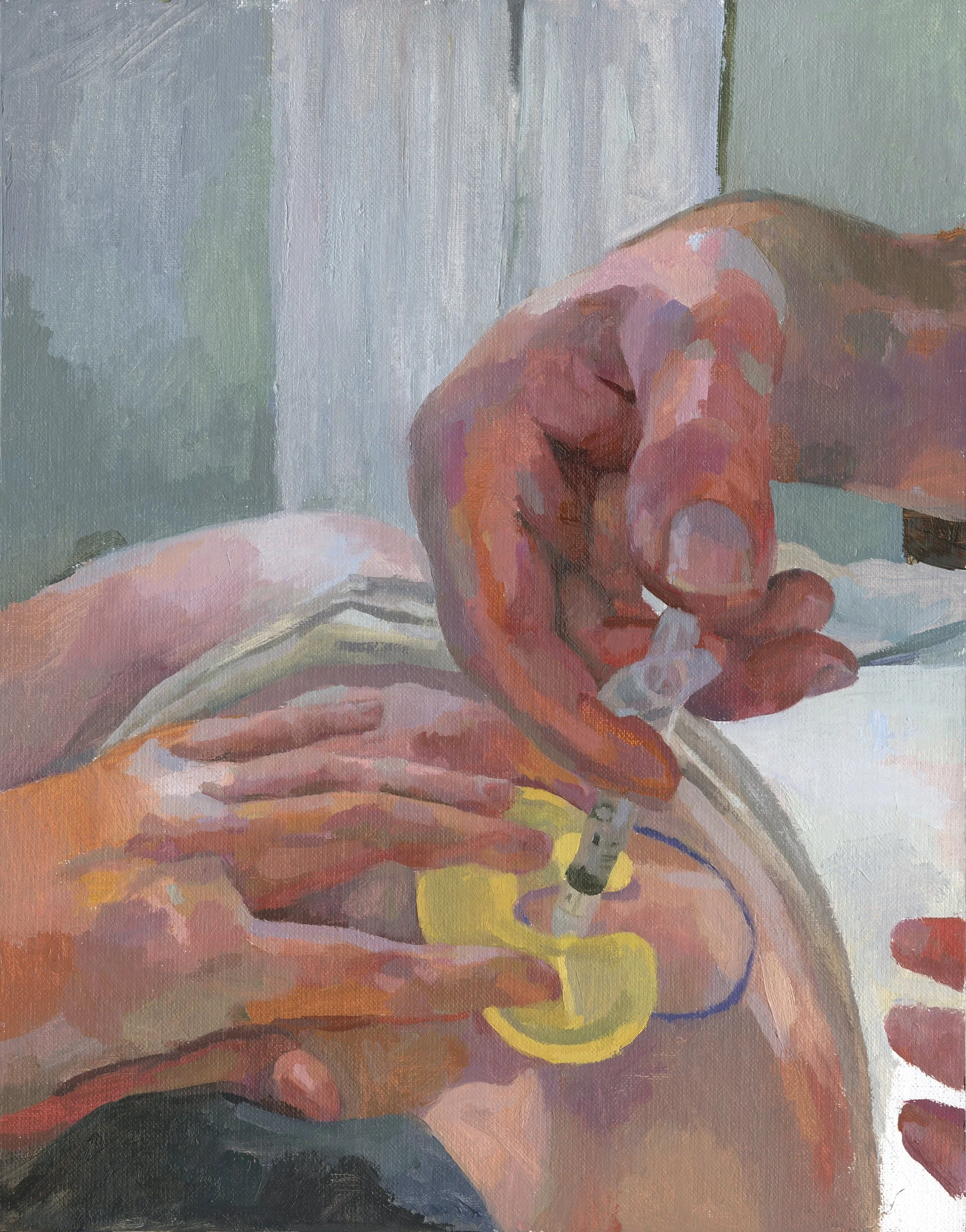 (ART) Assisted Reproductive Technology)
