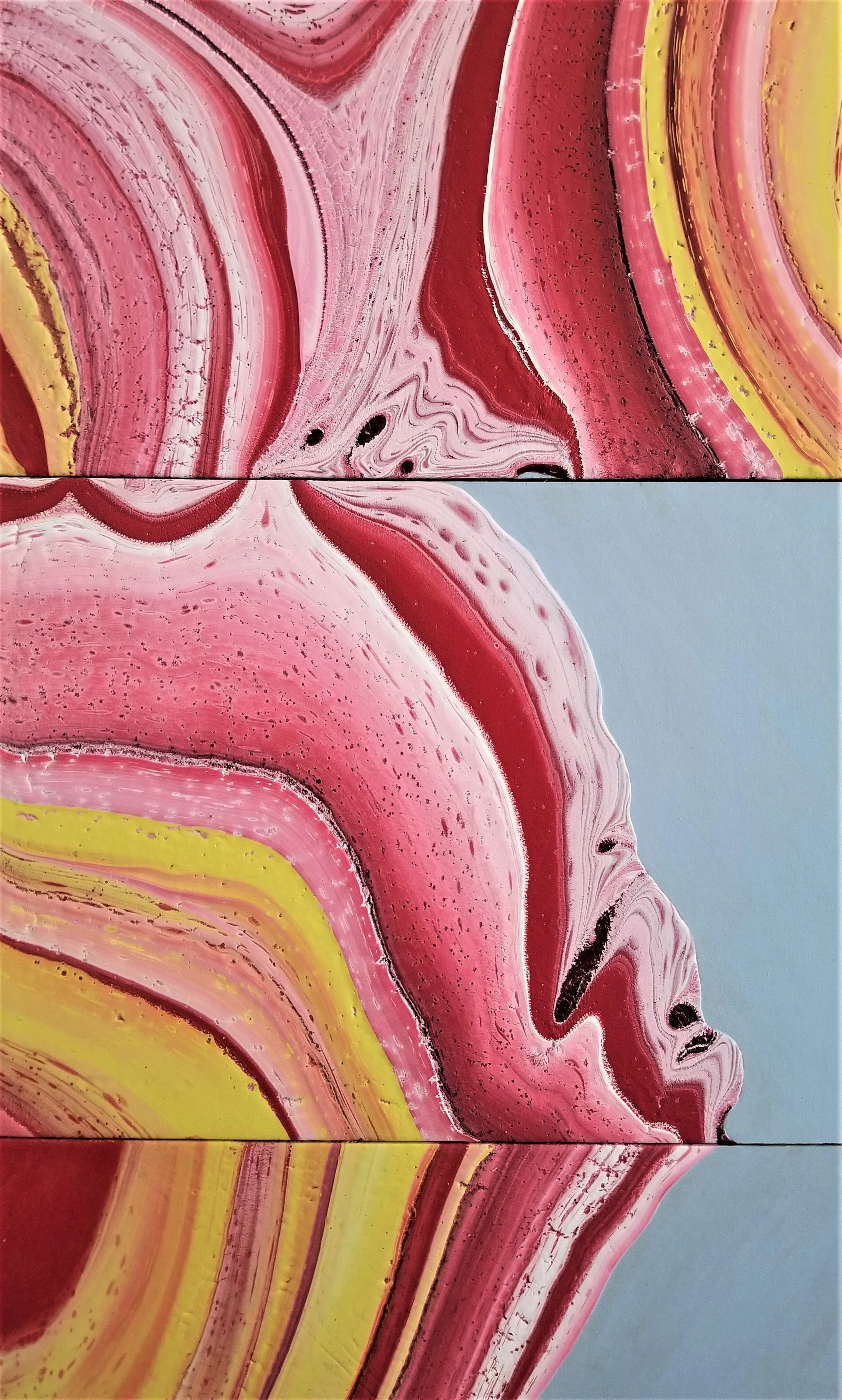  *detail 