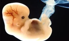 Human embryo at 6 weeks.