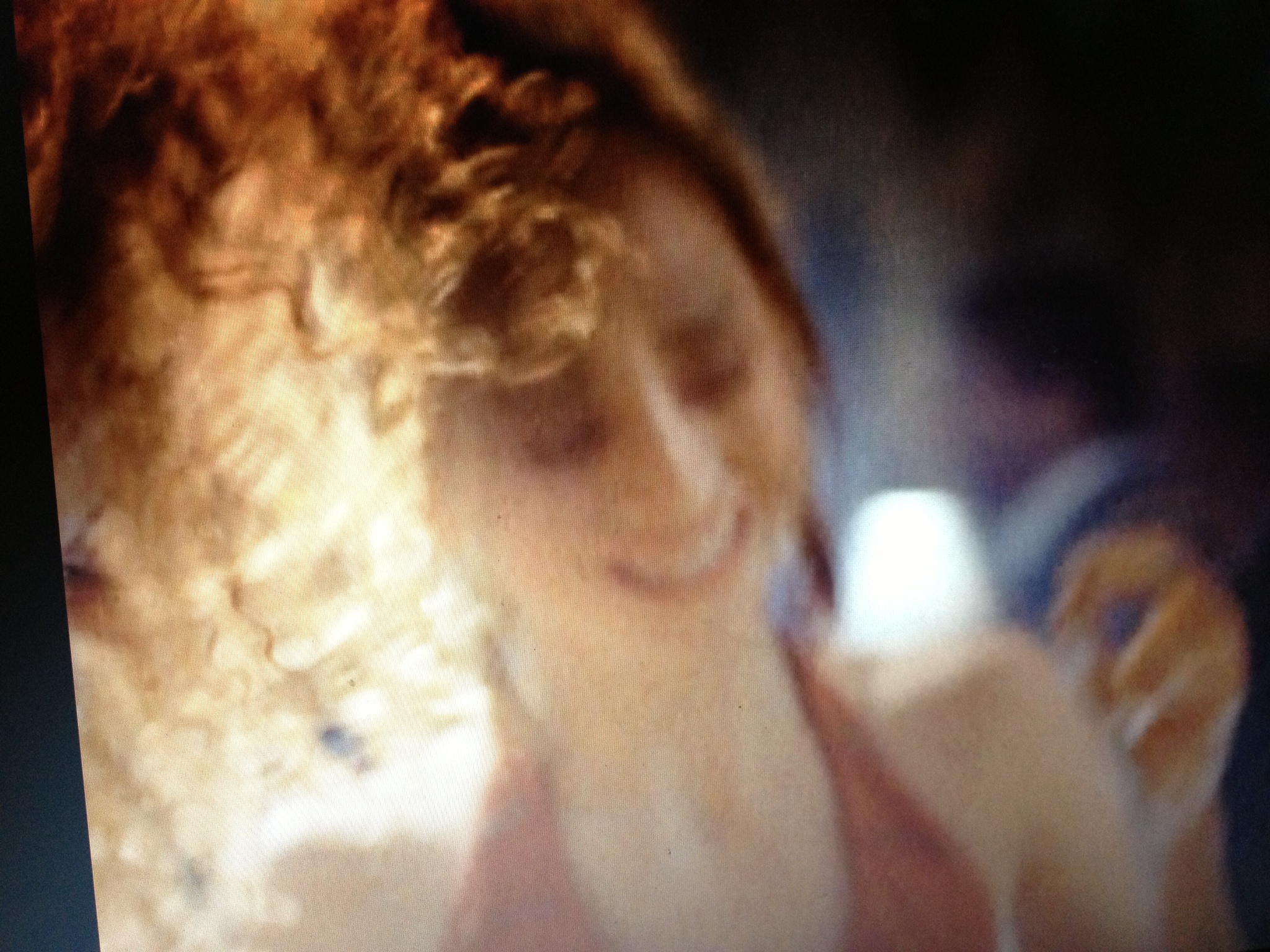   Ally 8, d igital Print, 2014 