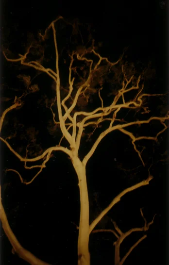 tree-skeleton++copy.jpg