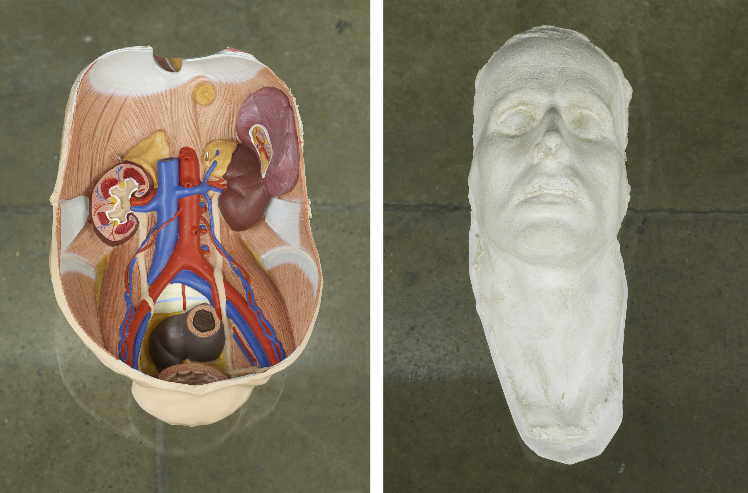      Untitled Vitrine   2012   Plastic anatomical model, silicone mould and plaster cast of a death mask, grasshopper with human hair antennae, glass vitrine   92 x 57.5 x 170 cm / 36.2 x 22.6 x 67 in  