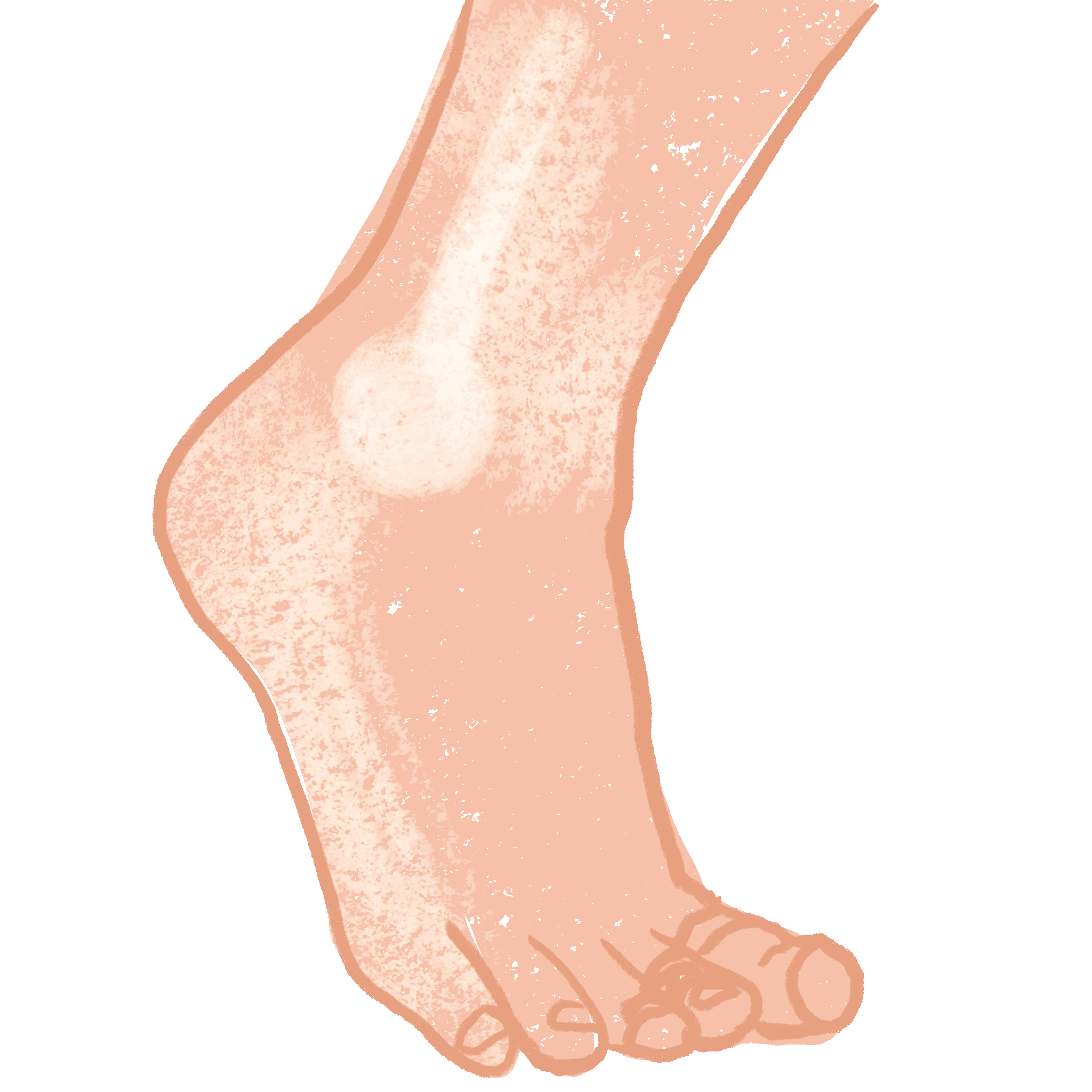 Feet Part One: A Terrible Blister