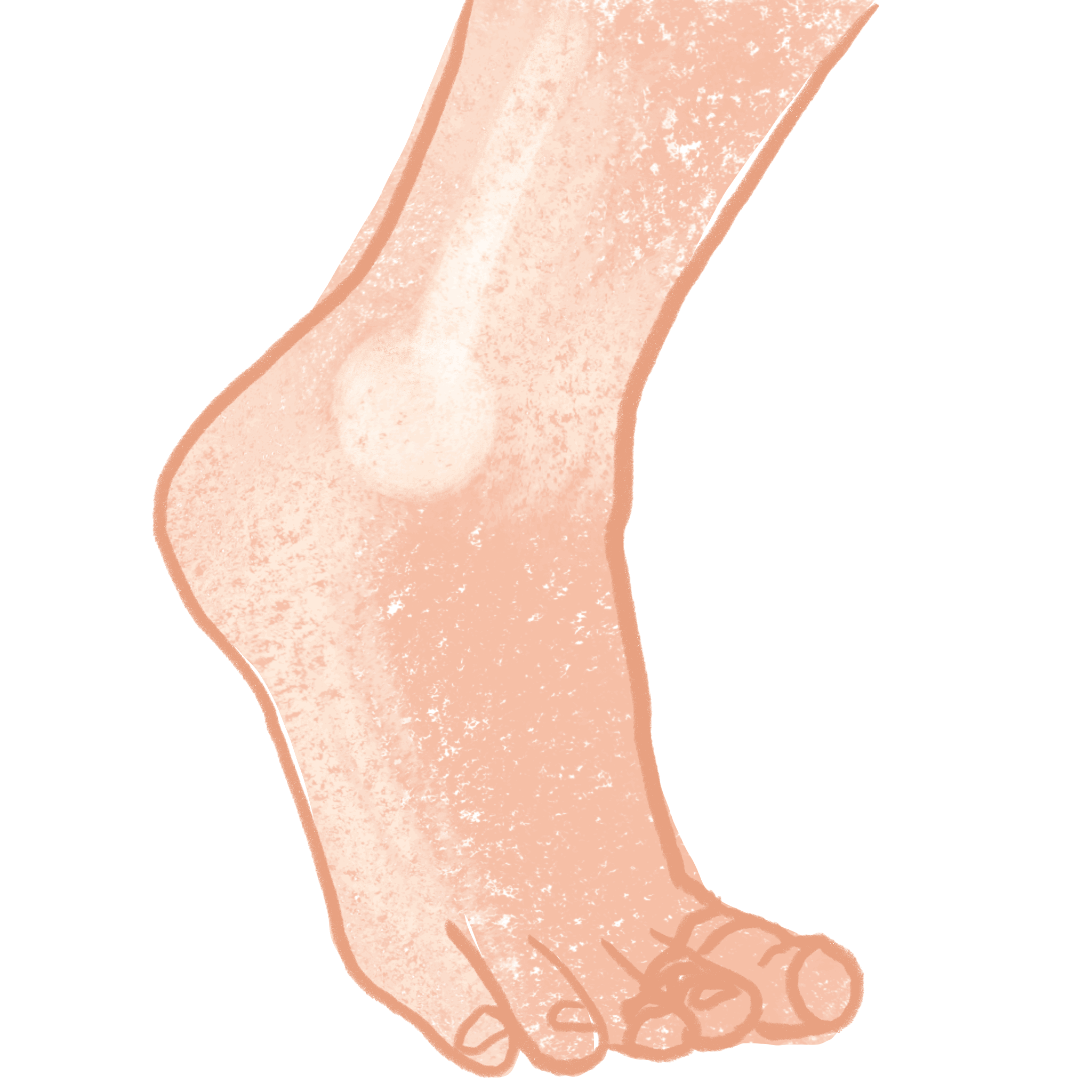 Feet Part Two:  The Yellow Jacket