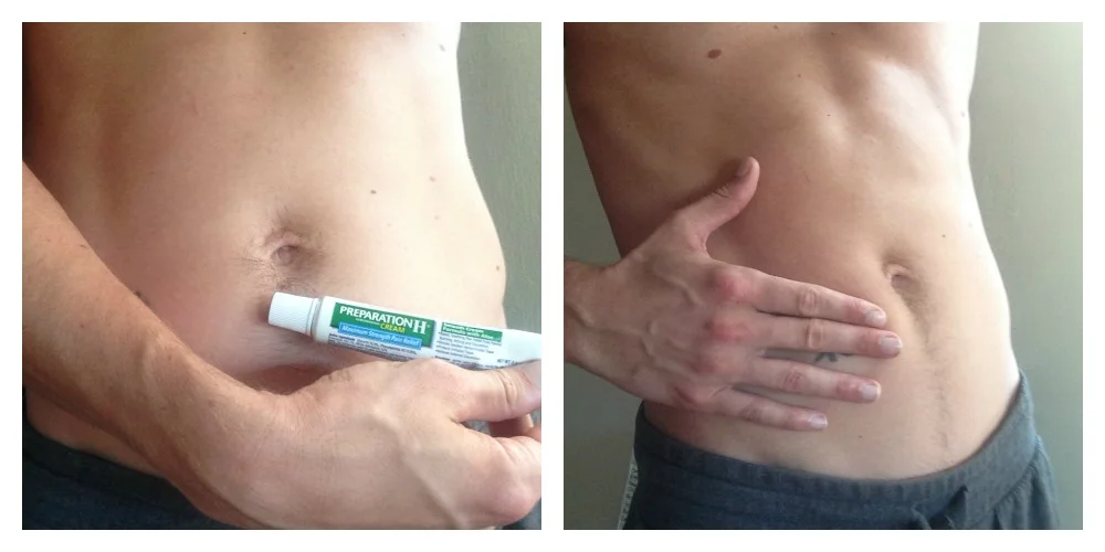 preparation h for loose skin